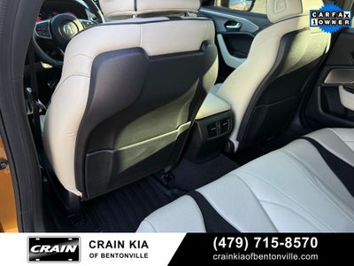 2021 Acura TLX Type S SH-AWD